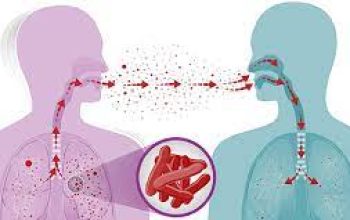 Illustrasi Tuberkolosis Illustrasi Tuberkolosis
